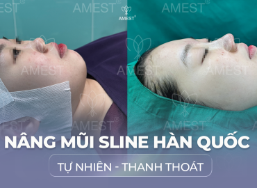 N&acirc;ng Mũi D&aacute;ng H&agrave;n Quốc: D&aacute;ng Mũi H&agrave;i H&ograve;a - Tự Nhi&ecirc;n - Thanh Tho&aacute;t