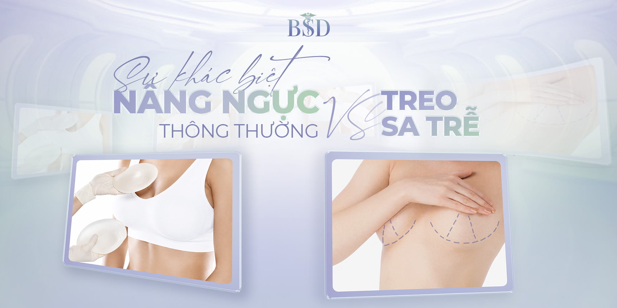 N&acirc;ng Ngực Kh&aacute;c G&igrave; Treo Sa Trễ? G&oacute;c Nh&igrave;n Từ Chuy&ecirc;n Gia Thẩm Mỹ