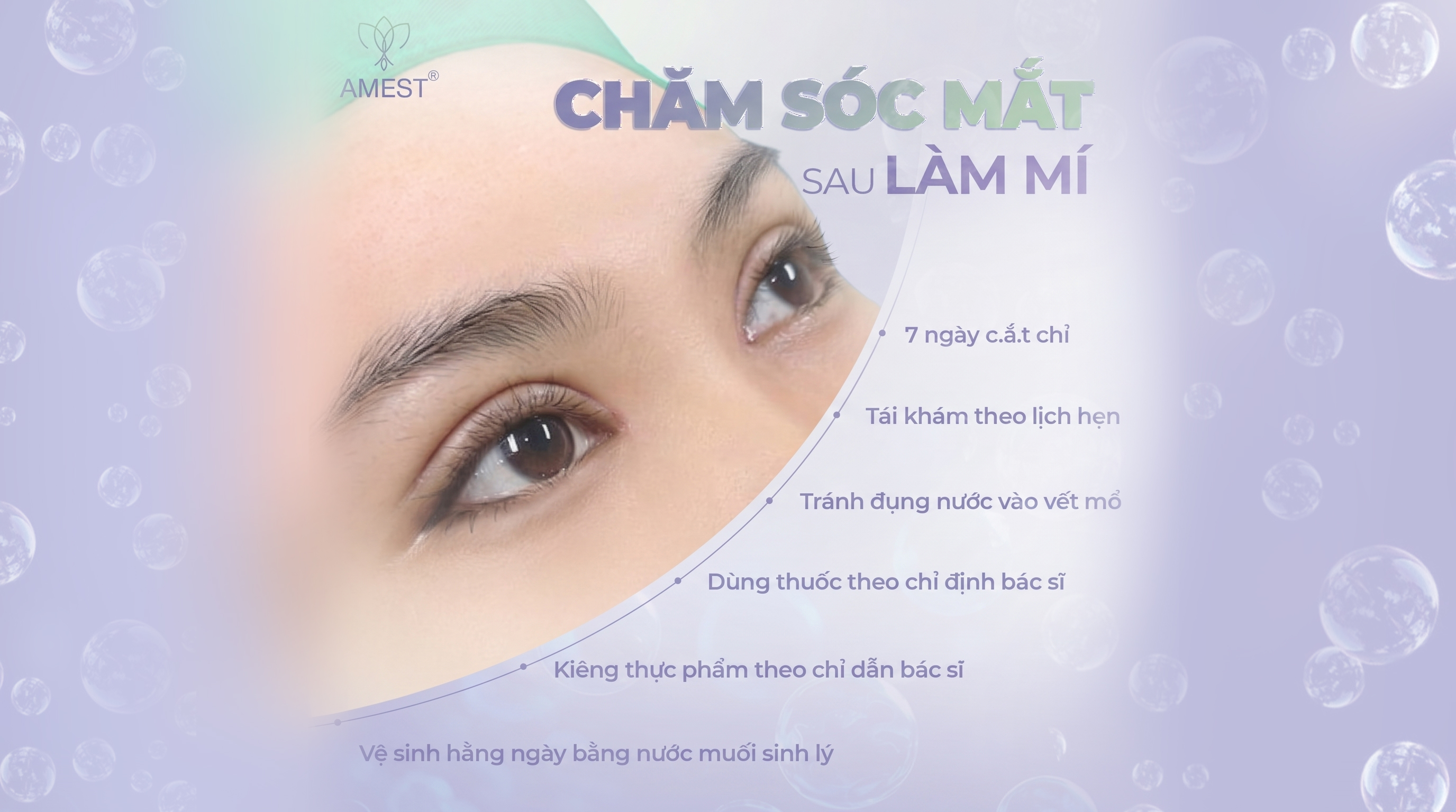 Hướng Dẫn Chăm S&oacute;c Mắt Sau Cắt M&iacute; Chuẩn Y Khoa