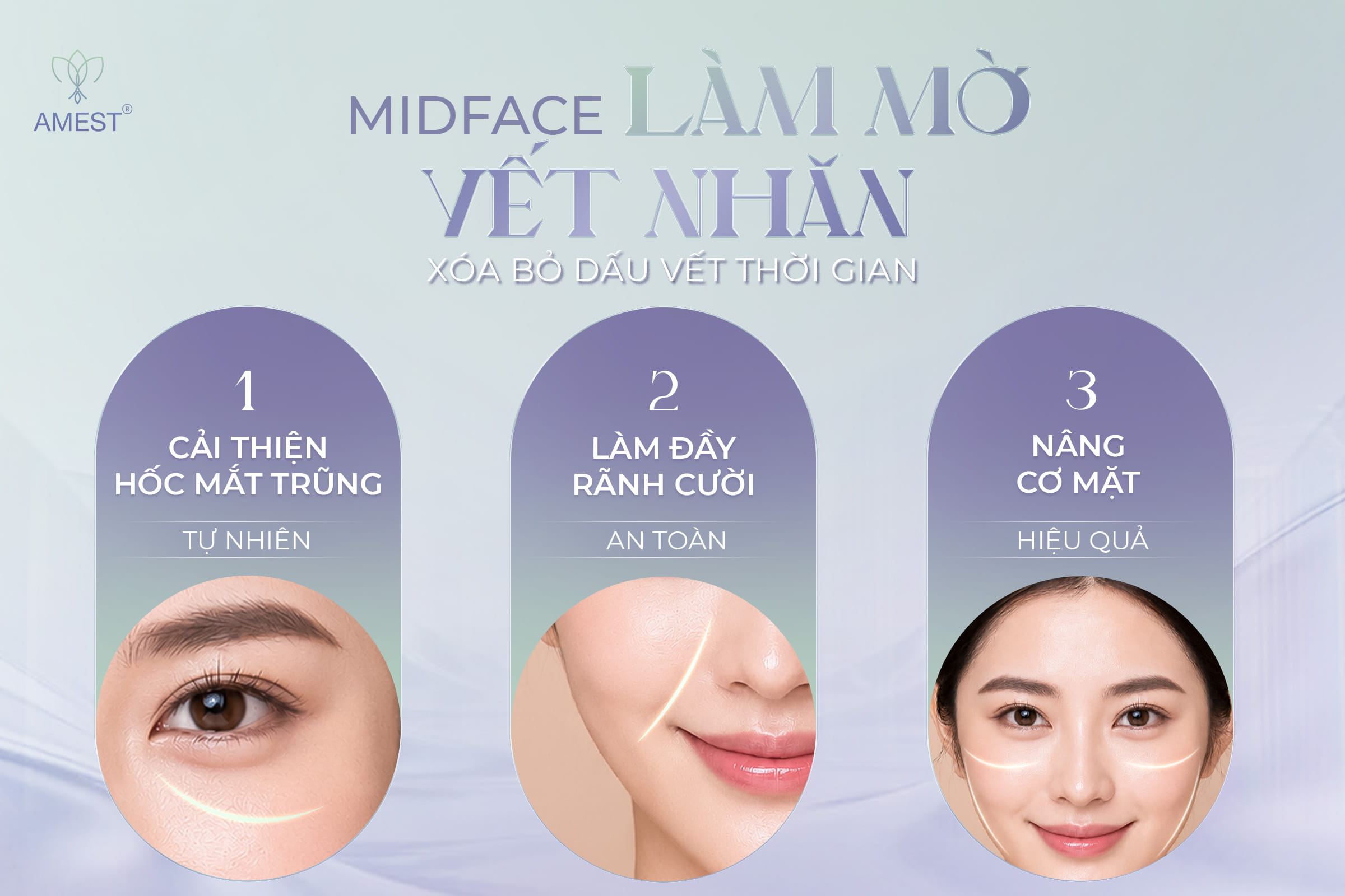 Midface L&agrave; G&igrave;? Tại Sao Gọi Đ&acirc;y L&agrave; Phương Ph&aacute;p &ldquo;1 Mũi T&ecirc;n Tr&uacute;ng 3 Đ&iacute;ch&rdquo;