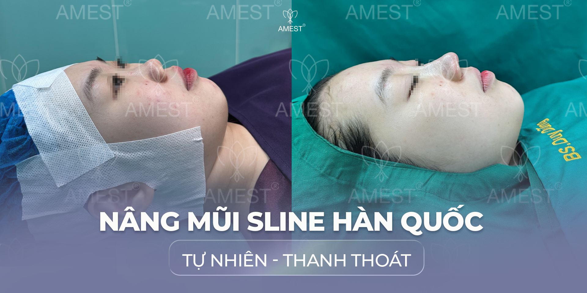 N&acirc;ng Mũi D&aacute;ng H&agrave;n Quốc: D&aacute;ng Mũi H&agrave;i H&ograve;a - Tự Nhi&ecirc;n - Thanh Tho&aacute;t