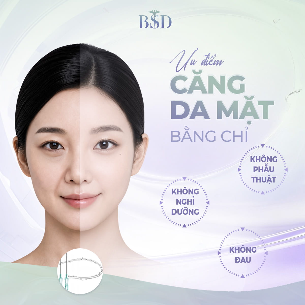 Căng Da Mặt Bằng Chỉ L&agrave; G&igrave;? Ưu Điểm V&agrave; Hiệu Quả Thực Tế